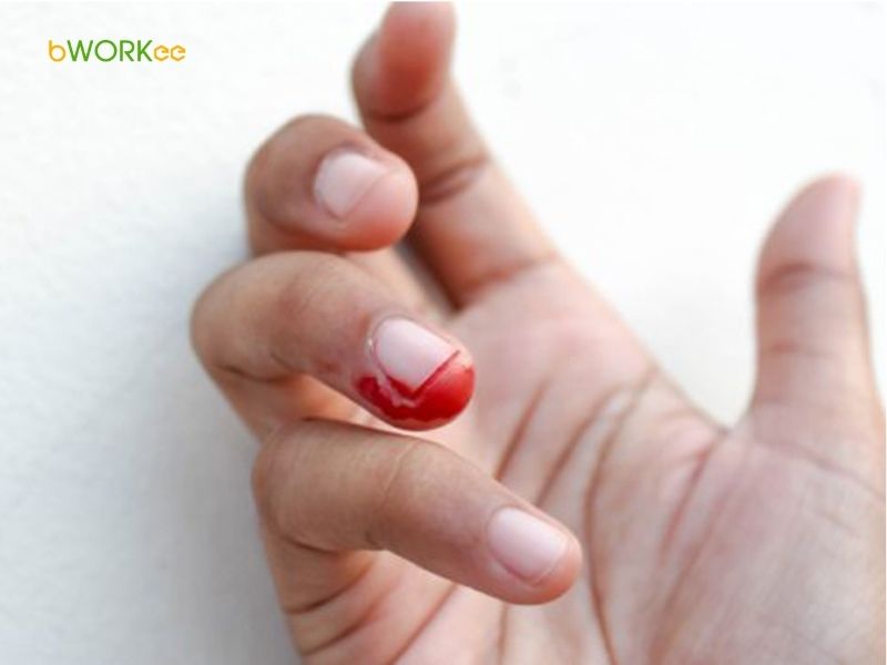 Gây đau nhức, khó chịu và chảy máu