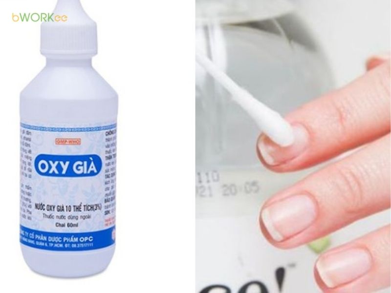 D&ugrave;ng oxy gi&agrave; để l&agrave;m trắng m&oacute;ng an to&agrave;n